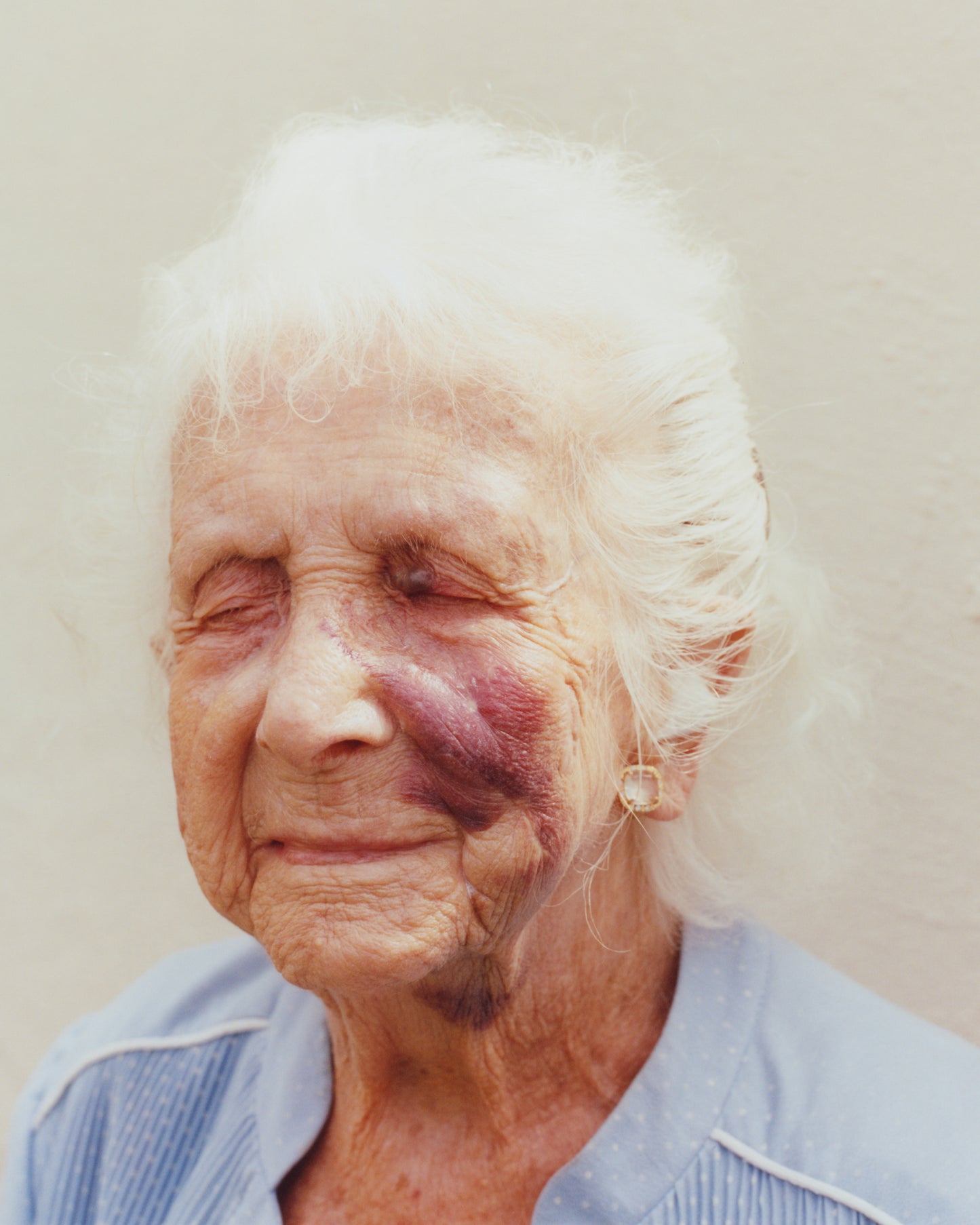 Laura McCluskey, Close to Home, Bruise