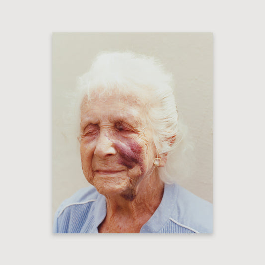 Laura McCluskey, Close to Home, Bruise